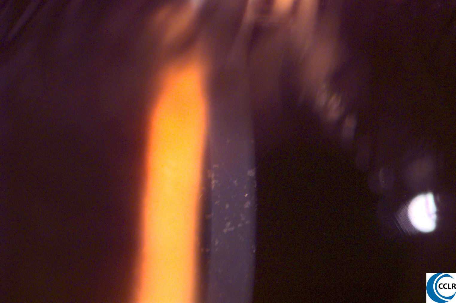 Debris Contact Lens Update