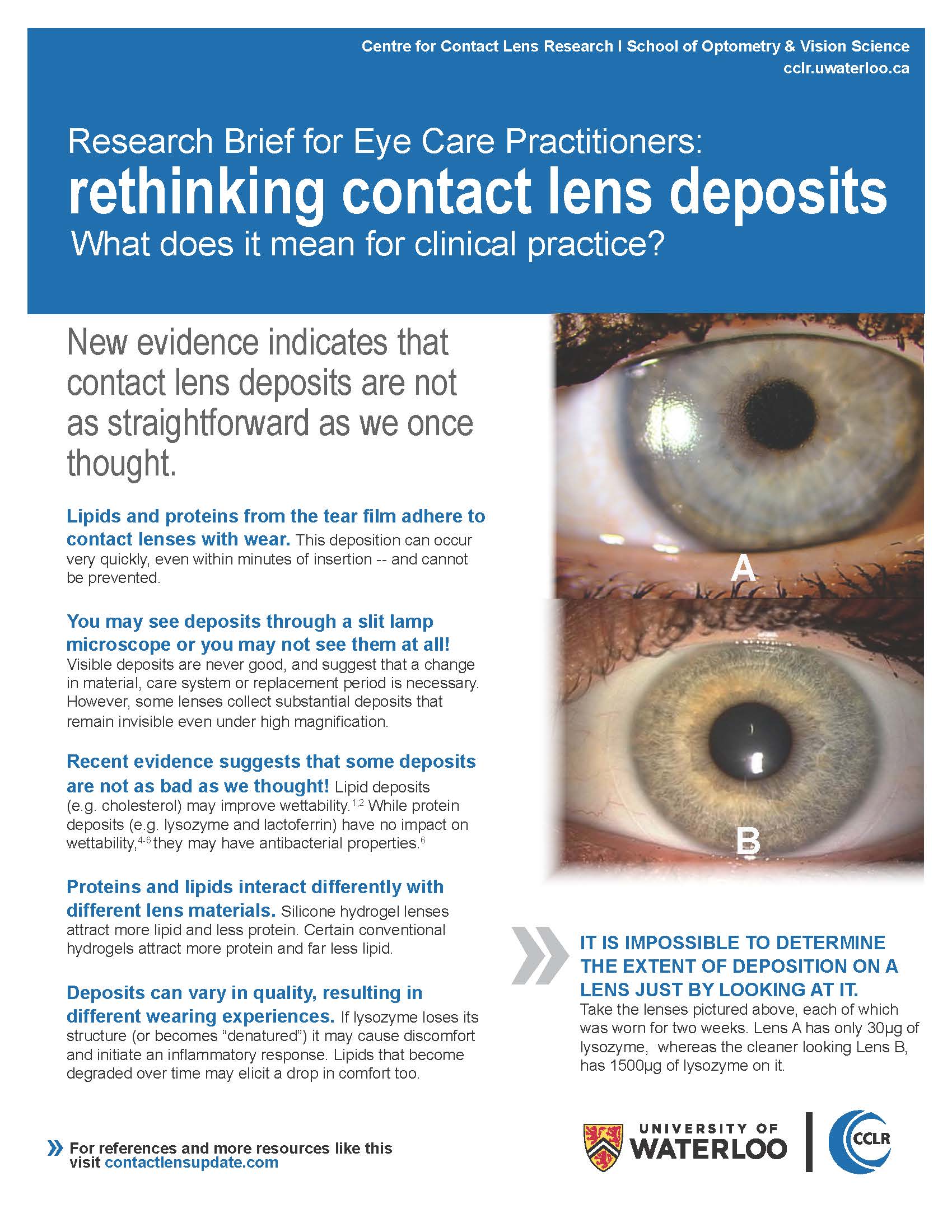 Research brief Rethinking contact lens deposits Contact Lens Update