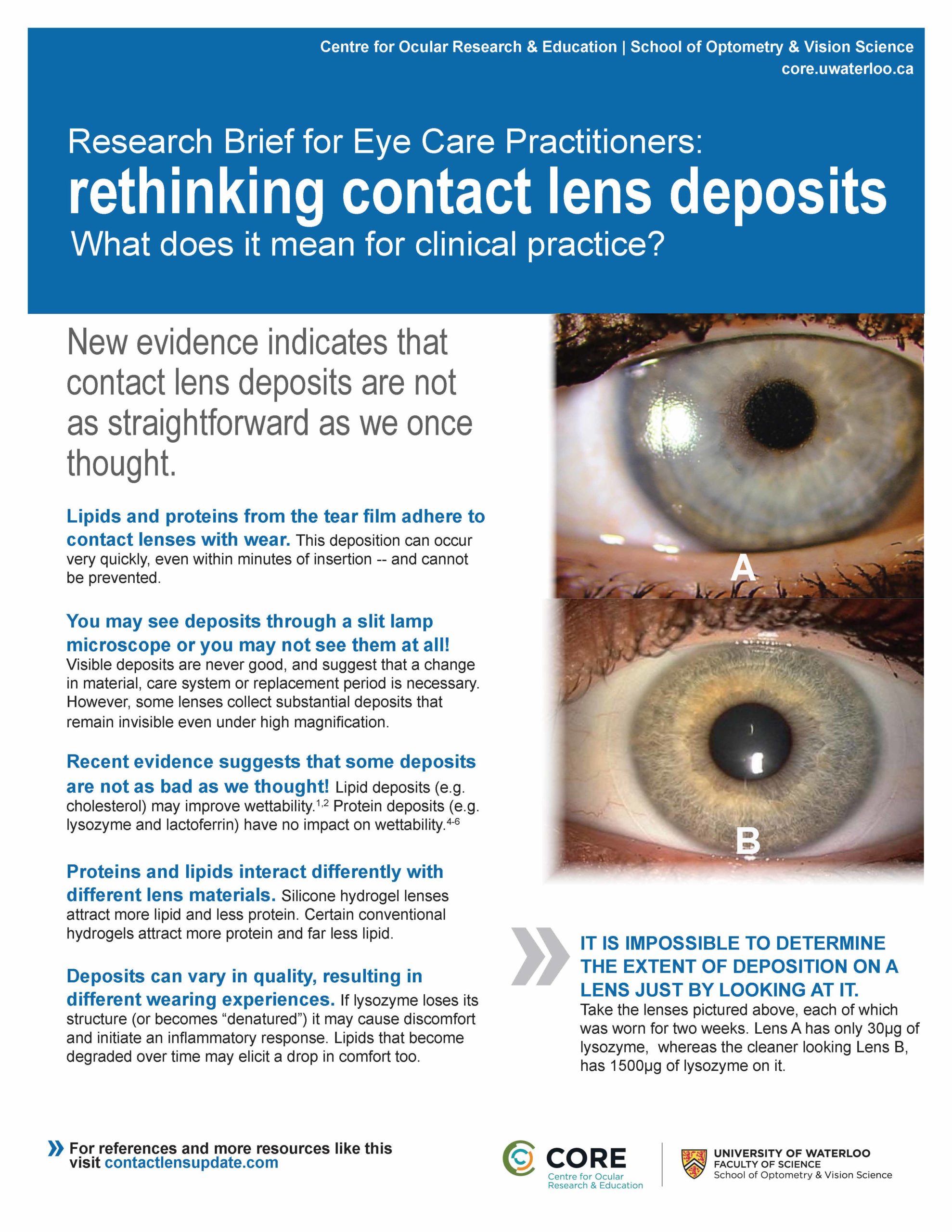 Research brief Rethinking contact lens deposits Contact Lens Update